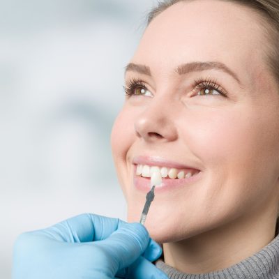 Dental Veneers
